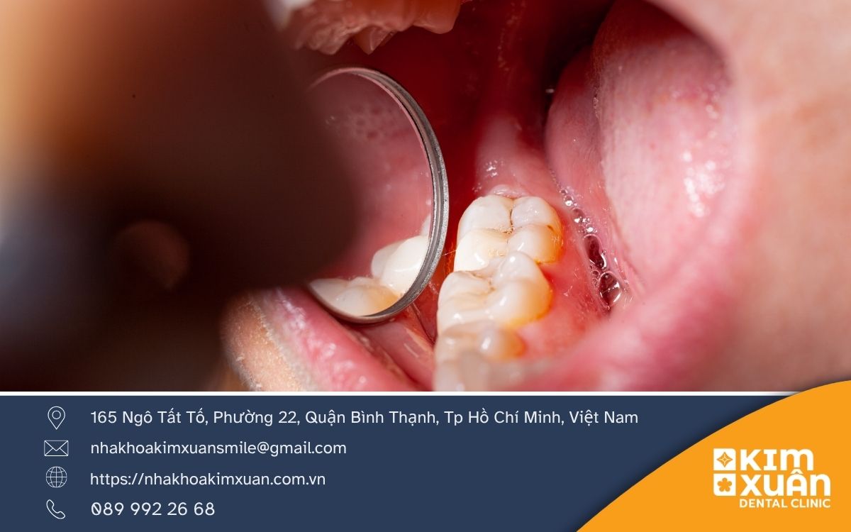 Khi Nào Nên Đến Gặp Nha Sĩ