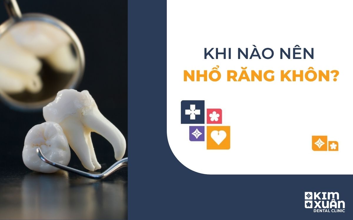 Khi Nào Nên Nhổ Răng Khôn