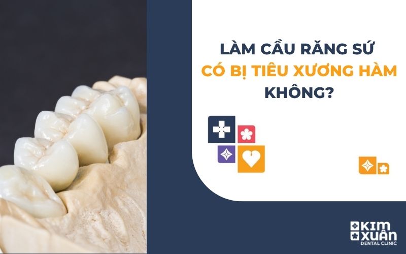Làm Cầu Răng Sứ Có Bị Tiêu Xương Hàm Không