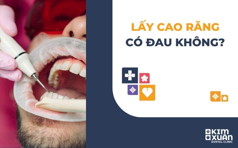 Lấy Cao Răng Có Đau Không