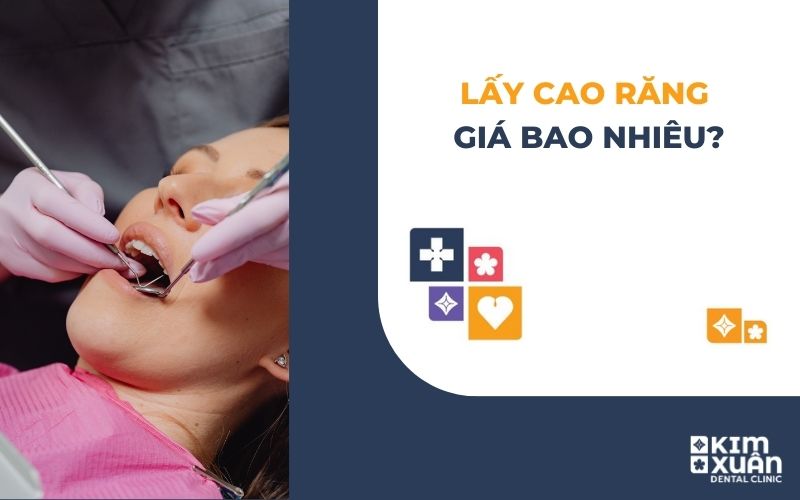 Lấy Cao Răng Giá Bao Nhiêu