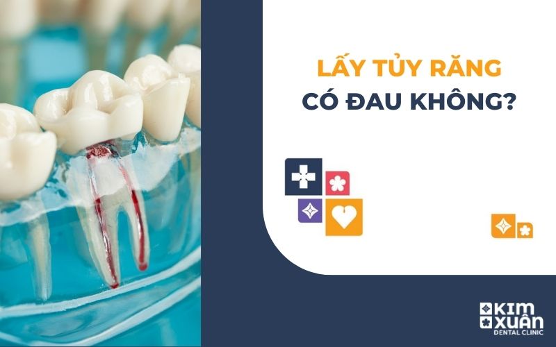 Lấy Tủy Răng Có Đau Không