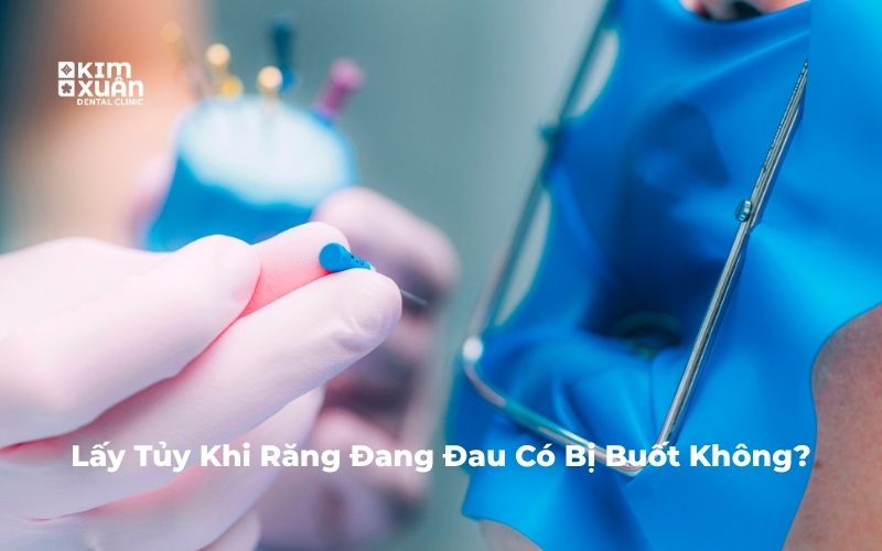 Lấy tủy răng đang đau có bị ê buốt không