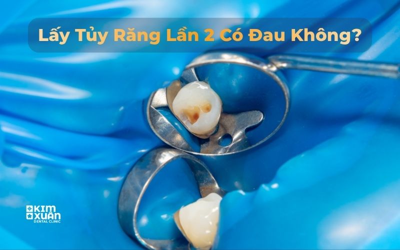 Lấy Tủy Lần 2 Có Đau Không
