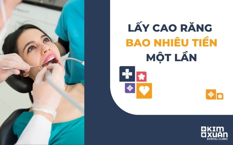 Lấy Vôi Răng Giá Bao Nhiêu