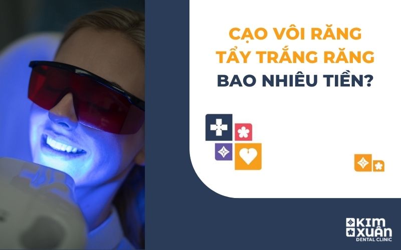 Lấy Vôi Răng Tẩy Trắng Răng Giá Bao Nhiêu