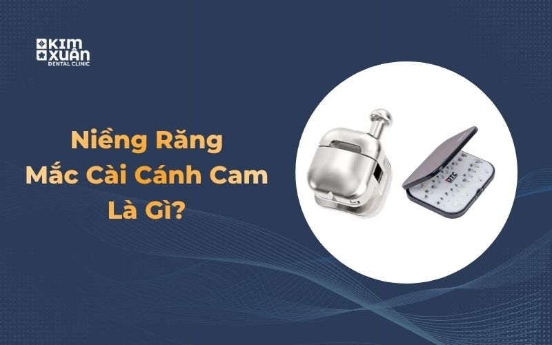 Mắc cài cánh cam