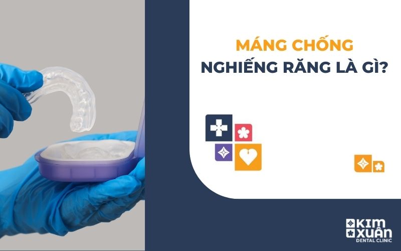 Máng Chống Nghiến Răng Khi Ngủ
