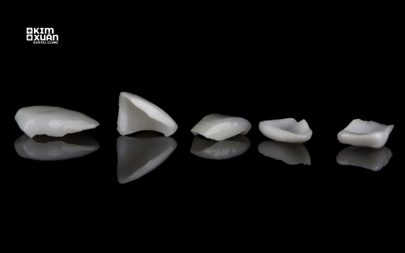 Mặt Dán Sứ Veneer