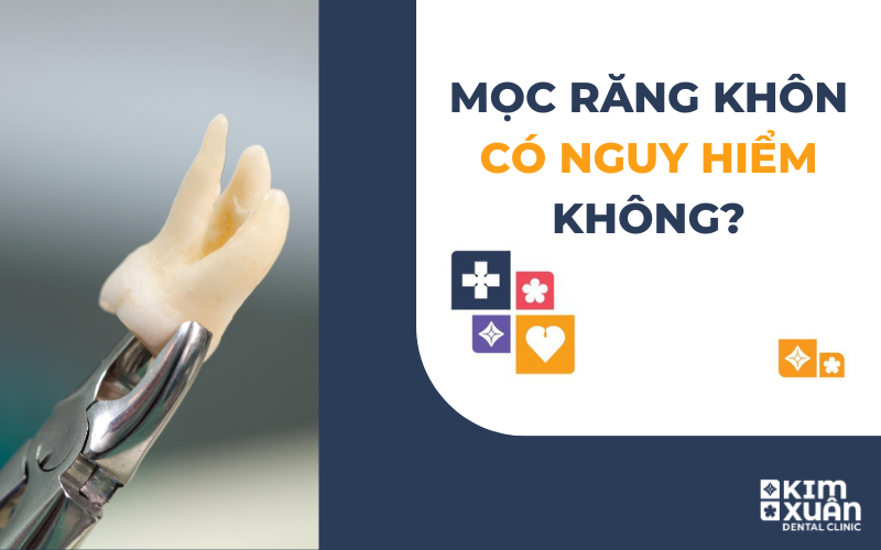 Mọc Răng Khôn Có Nguy Hiểm Không