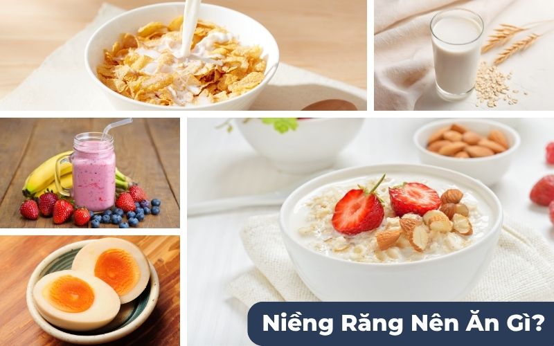 Mới Niềng Răng Nên Ăn Gì