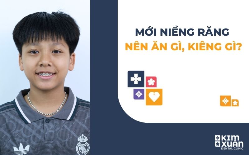 Mới Niềng Răng Nên Ăn Gì Kiêng Gì