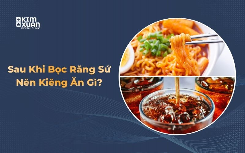 Nên kiêng gì ăn gì sau khi bọc răng sứ