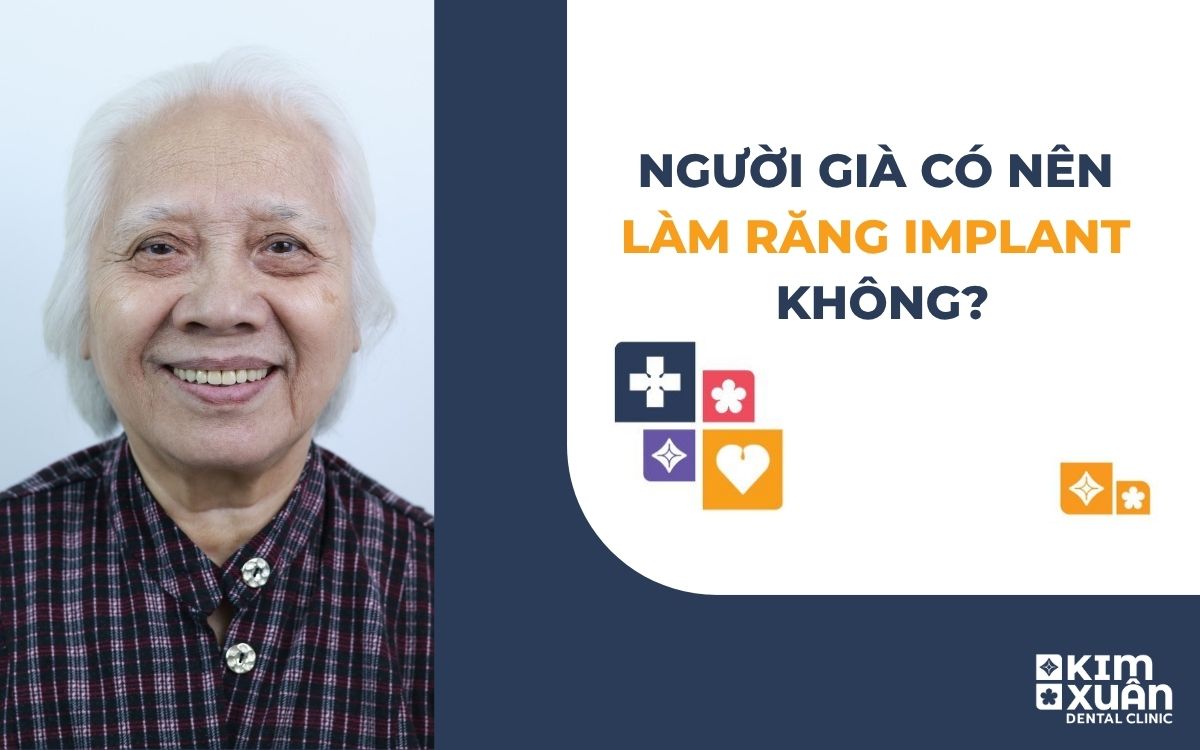 Người Già Có Nên Trồng Răng imlant Không?