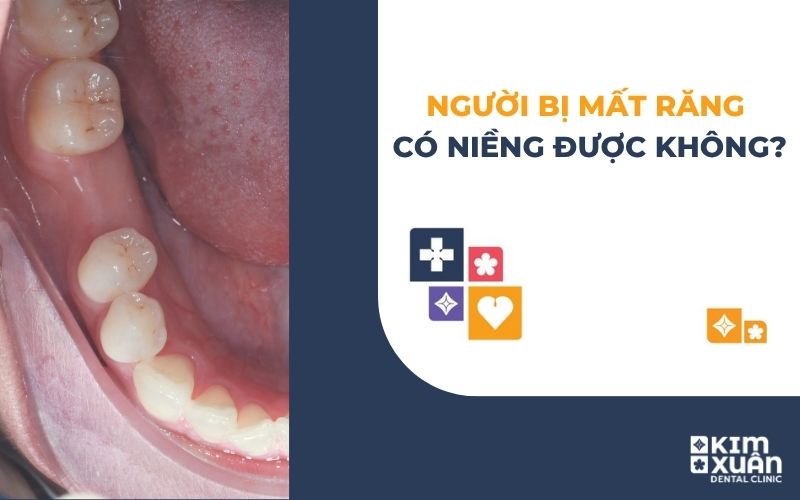 Người Mất Răng Có Niềng Răng Được Không