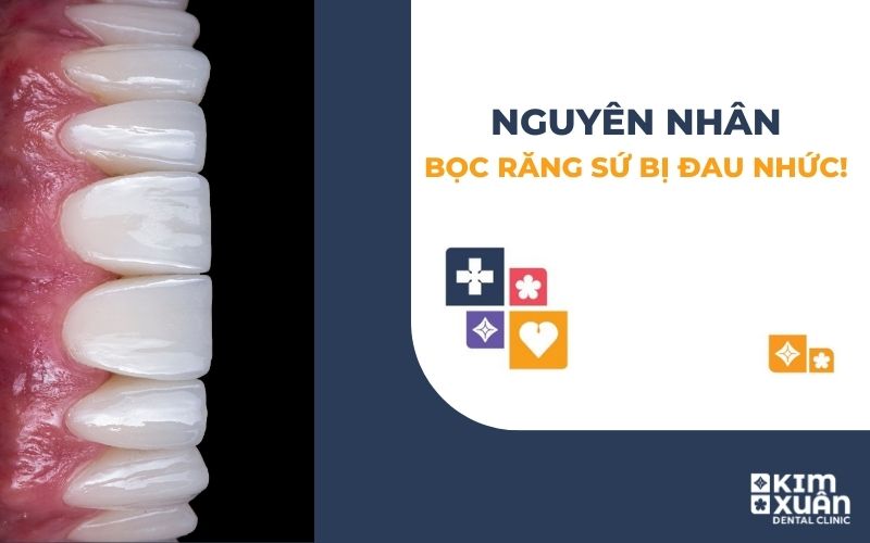 Nguyên Nhân Bọc Răng Sứ Bị Đau Nhức