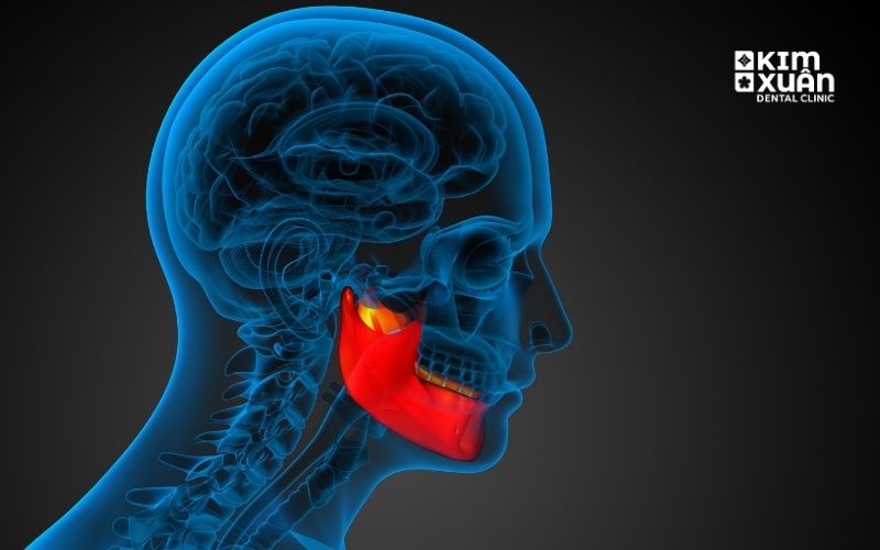 Nguyên Nhân Gây Đau Hàm - Đau Khớp Thái Dương Hàm