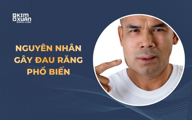 Nguyên Nhân Gây Đau Răng Phổ Biến