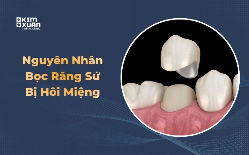 Nguyên Nhân Gây Hôi Miệng