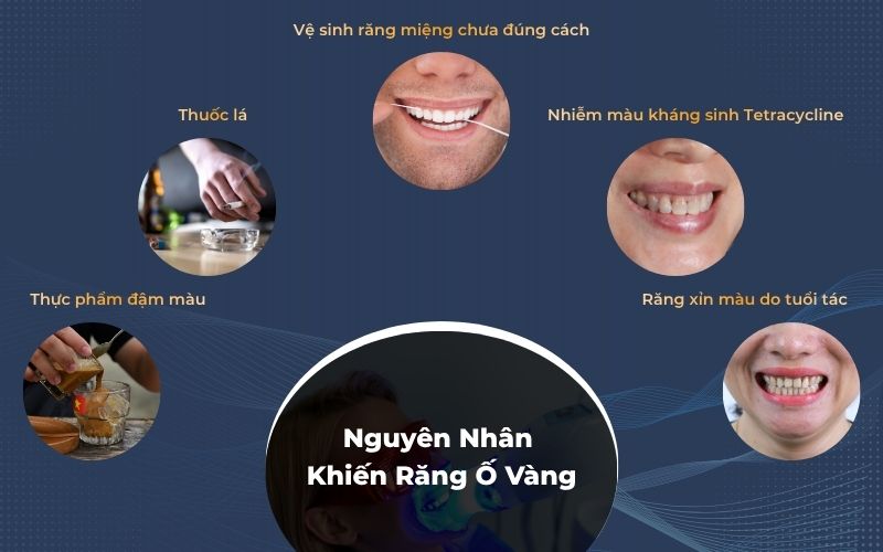 Các nguyên nhân khiến răng bị ố vàng và xỉn màu