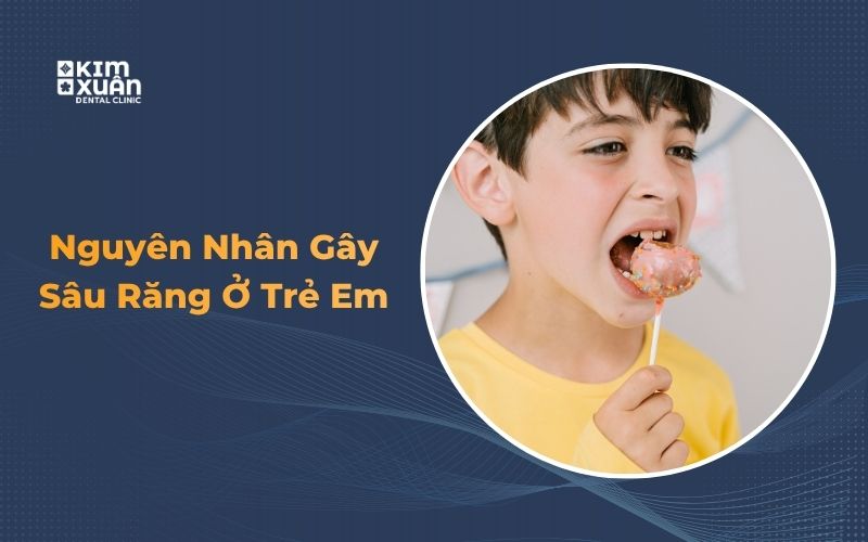 Nguyên Nhân Sâu Răng Ở Trẻ Em