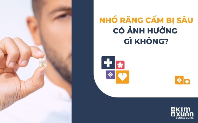 Nhổ Răng Cấm Bị Sâu Có Ảnh Hưởng Gì Không