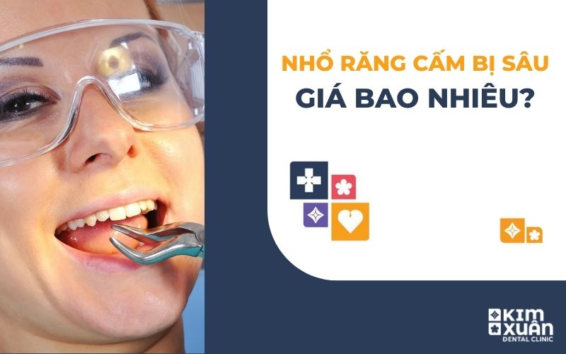 Nhổ Răng Cấm Bị Sâu Giá Bao Nhiêu Tiền