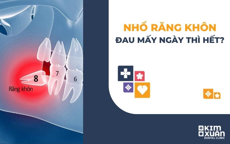 Nhổ Răng Khôn Đau Mấy Ngày Thì Hết