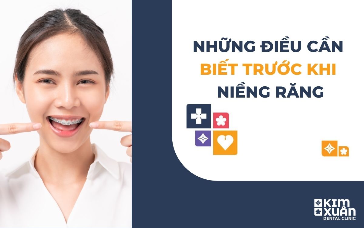 Những Điều Cần Biết Trước Khi Niềng Răng