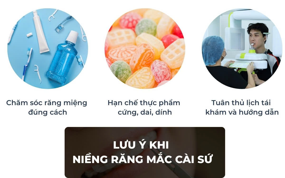 Những Lưu Ý Khi Niềng Răng Mắc Cài Sứ