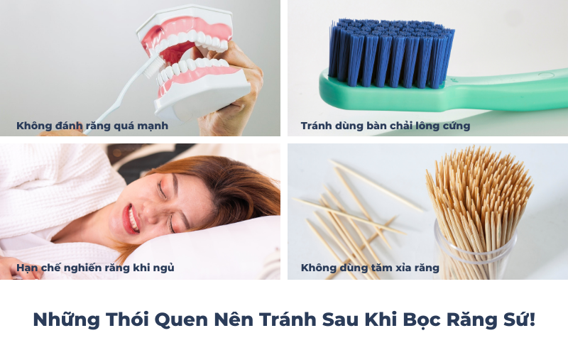 Những Thói Quen Nên Tránh Sau Khi Bọc Răng Sứ