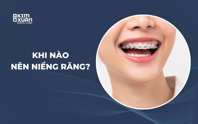 Những Trường Hợp Nên Niềng Răng