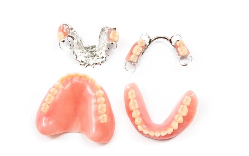 Nhược Điểm Của Trồng Răng Tháo Lắp