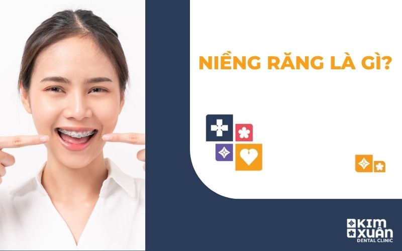 Niềng Răng Chỉnh Nha