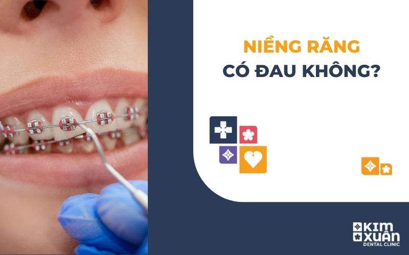 Niềng Răng Chỉnh Nha Có Đau Không
