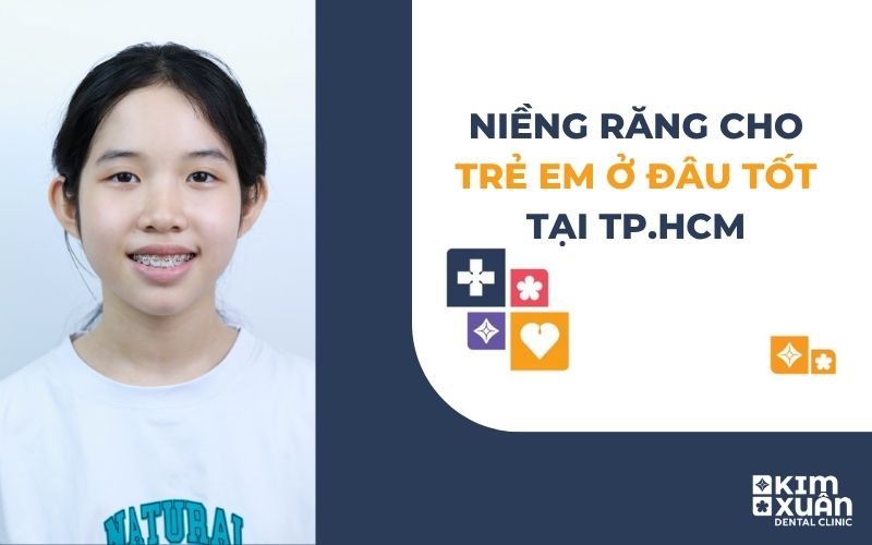 Niềng Răng Chỉnh Nha Ở Đâu Tốt Tp. HCM