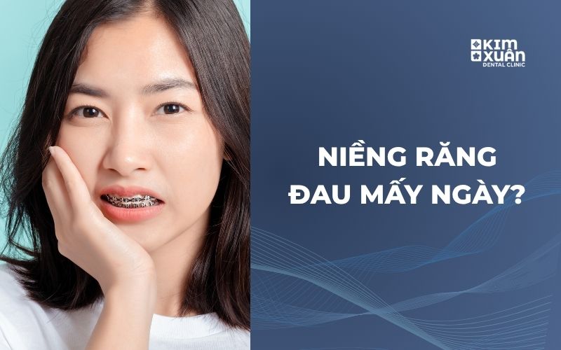Niềng Răng Đau Mấy Ngày Thì Hết Đau