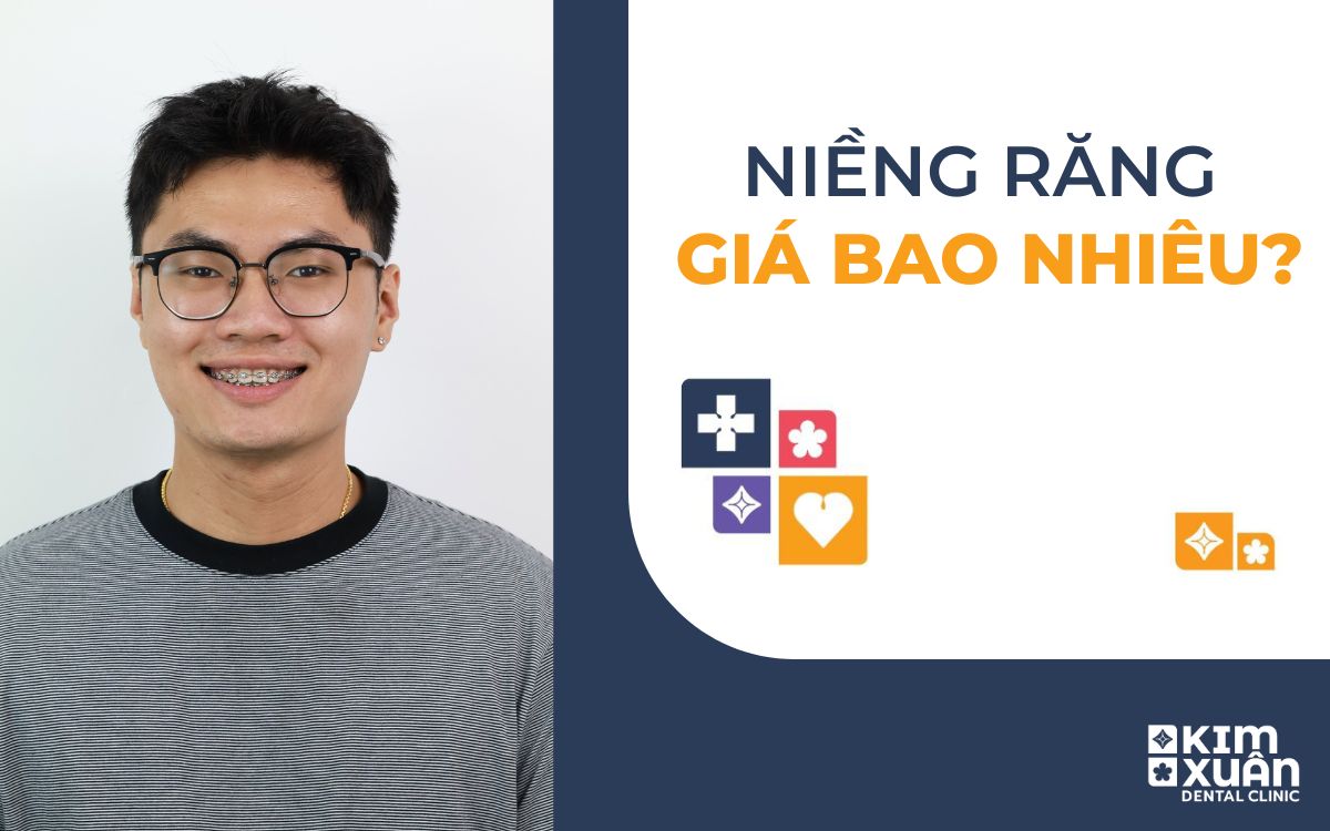 Niềng Răng Giá Bao Nhiêu 2025