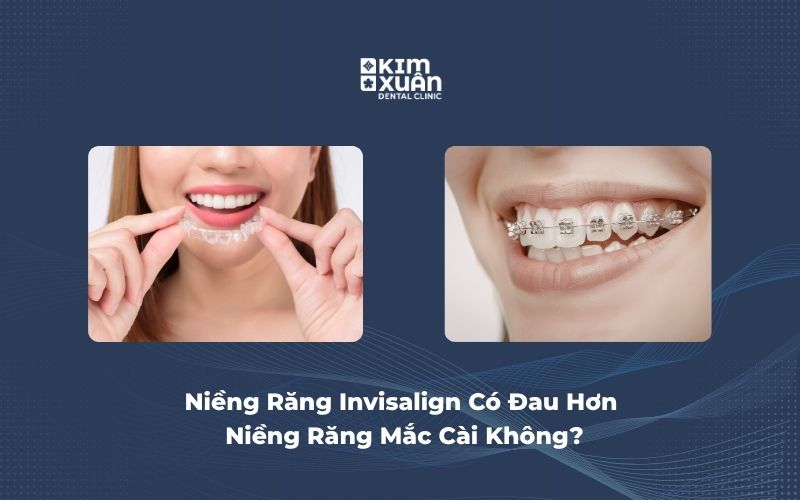 Niềng Răng Invisalign Có Đau Hơn Niềng Răng Mắc Cài Không