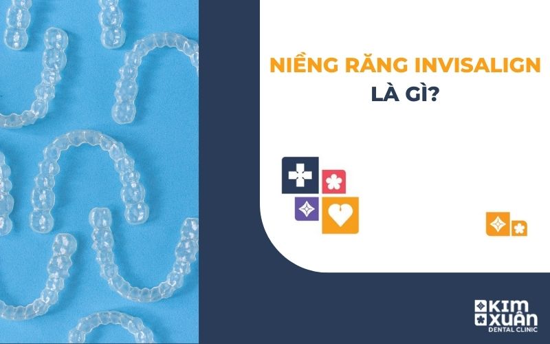 Niềng Răng Invisalign Là Gì