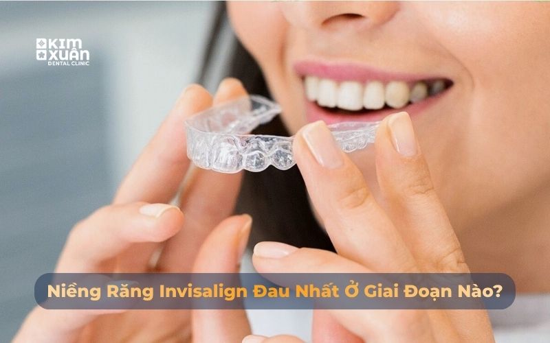 Niềng Răng Máng Đau Nhất Giai Đoạn Nào