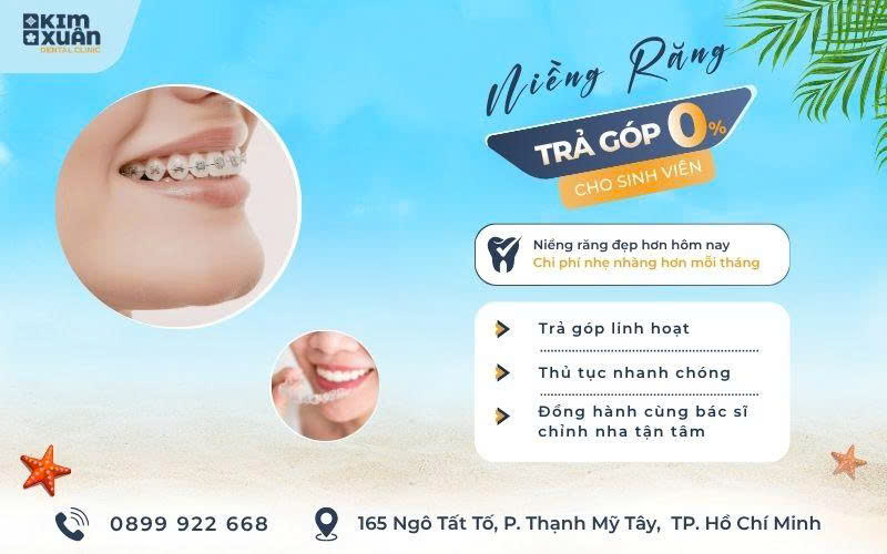 Niềng Răng Trả Góp Cho Sinh Viên