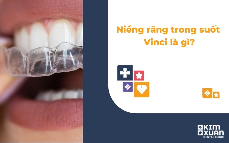 Niềng răng trong suốt Vinci