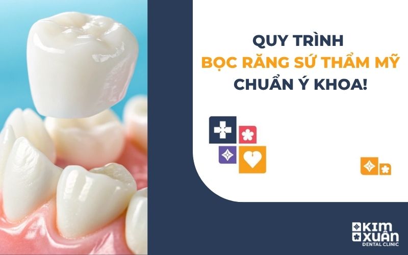 Quy Trình Bọc Răng Sứ