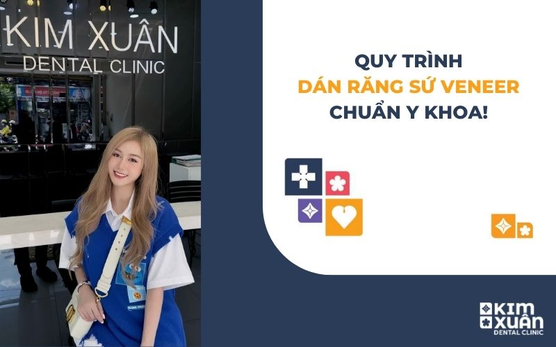 Quy Trình Dán Sứ Veneer