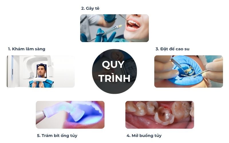Quy Trình Lấy Tủy Răng Tại Nha Khoa Bình Thạnh HCM