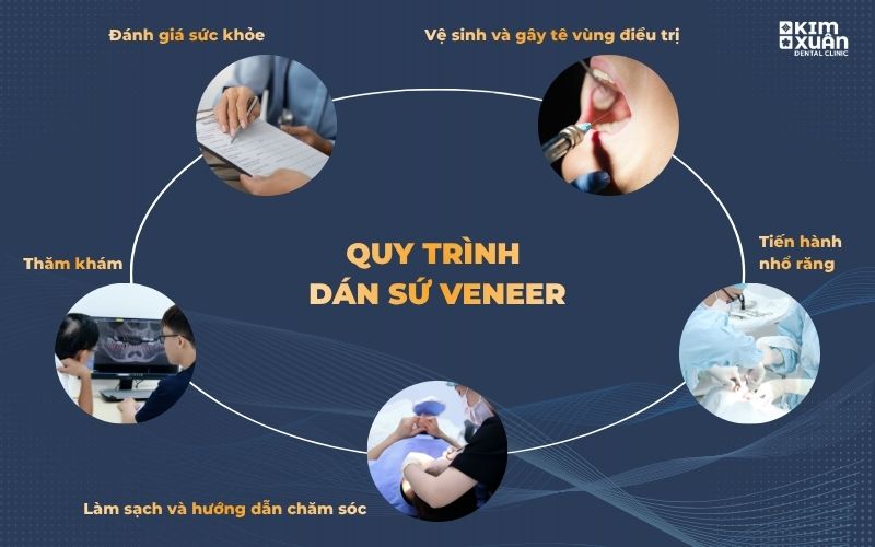 Quy trình nhổ răng khôn chuẩn y khoa tại nha khoa Kim Xuân