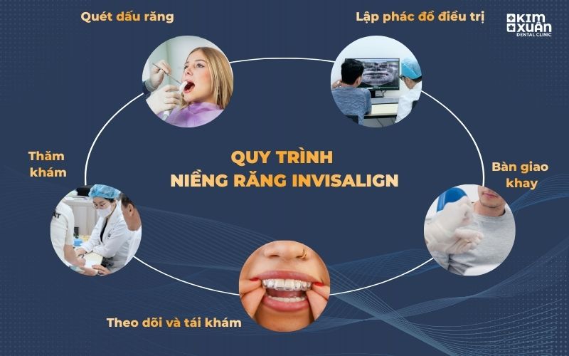 Quy Trình Niềng Răng Invisalign Chuẩn Y Khoa Tại Nha Khoa Kim Xuân