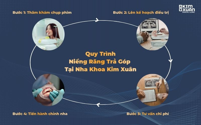 Quy trình Niềng Răng Trả Góp Cho Sinh Viên