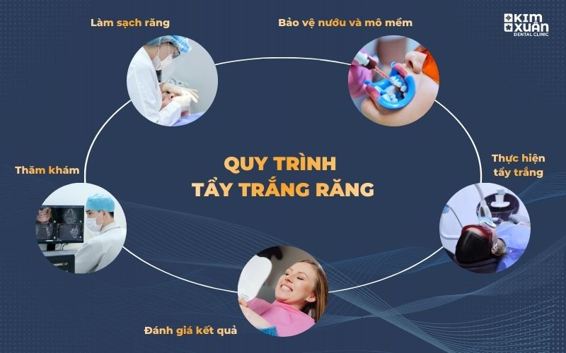 Quy trình Tẩy Trắng Răng Tại Nha Khoa Kim Xuân